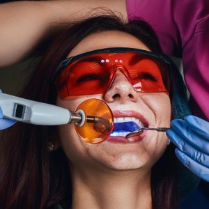 Laser Fillings
