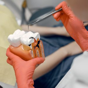 Wisdom Tooth Extraction